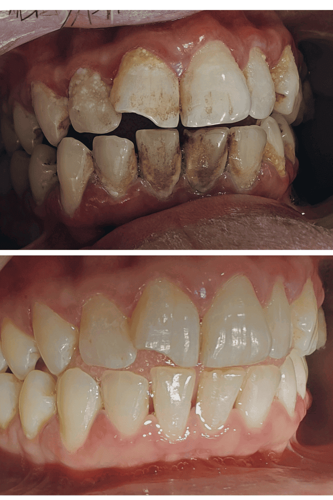 Confidence starts with a smile